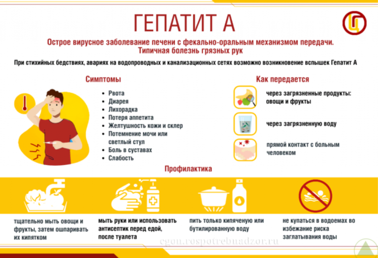 Гепатит А (болезнь Боткина) — острое вирусное поражение печени.
